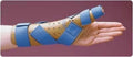Wrist and Thumb Spica A867